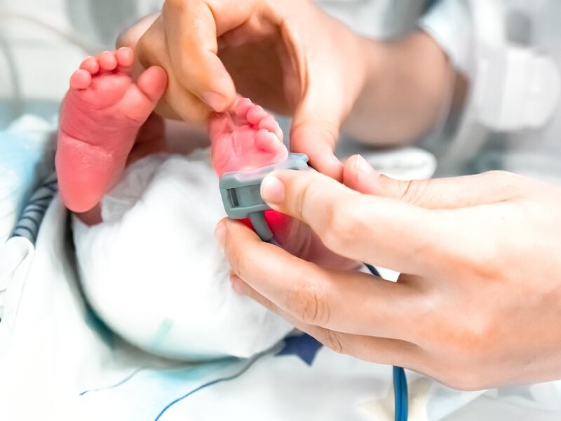 Adulto colocando un pulsioximetro neonatal en el pie de un recién nacido